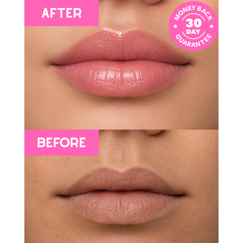 Fuller, Hydrated Lips by Morning